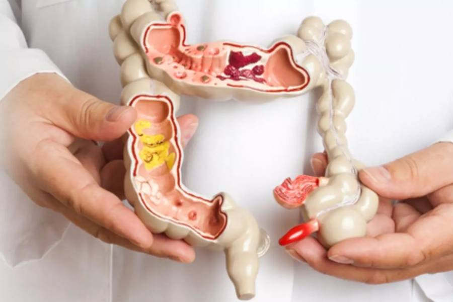 Colorectal Surgeon in Chennai