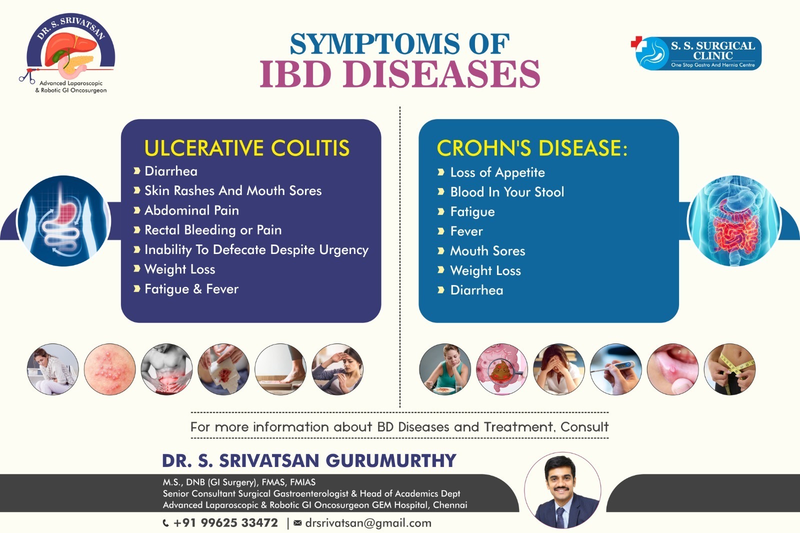 Symptoms of IBD Diseases