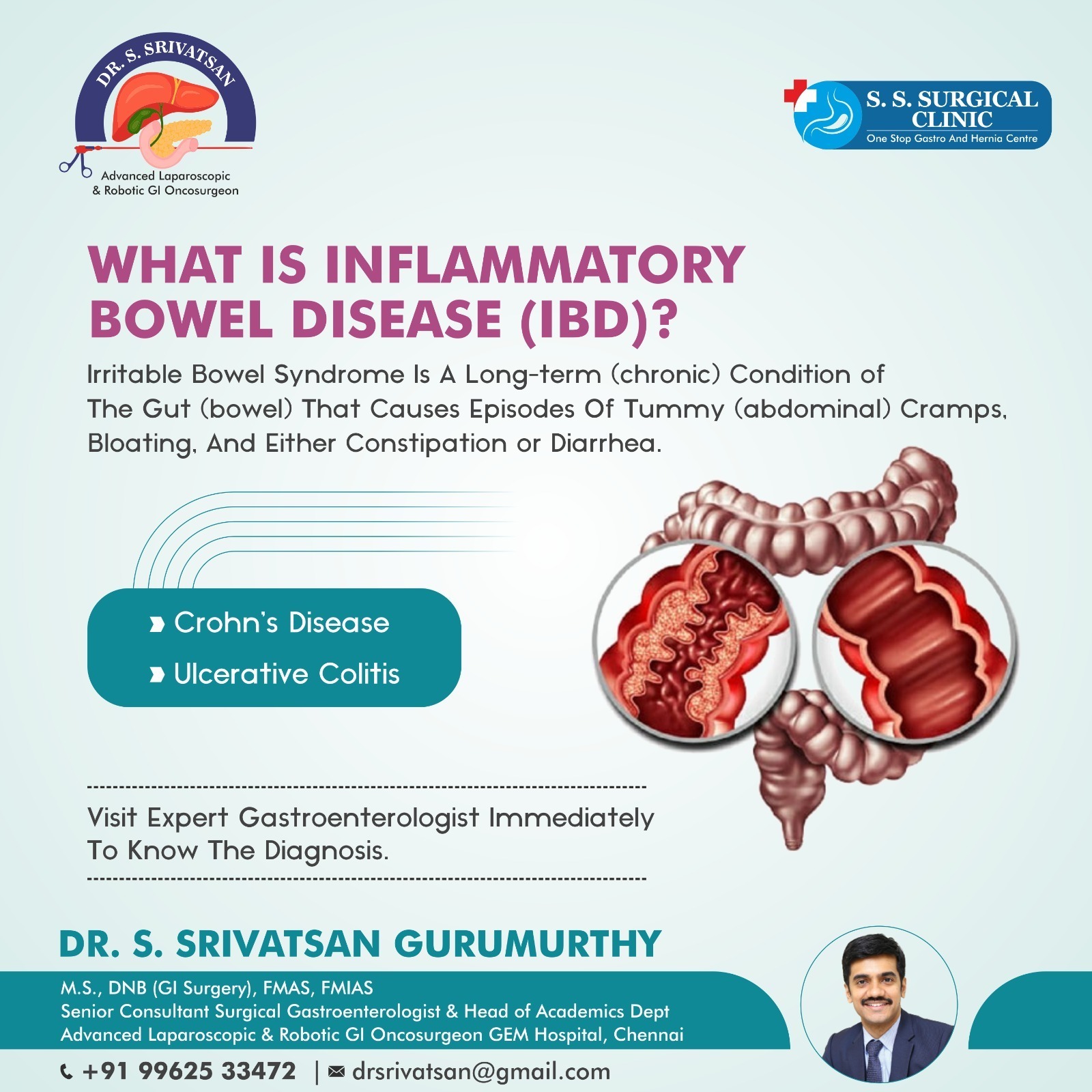 All About Inflammatory Bowel Diseases
