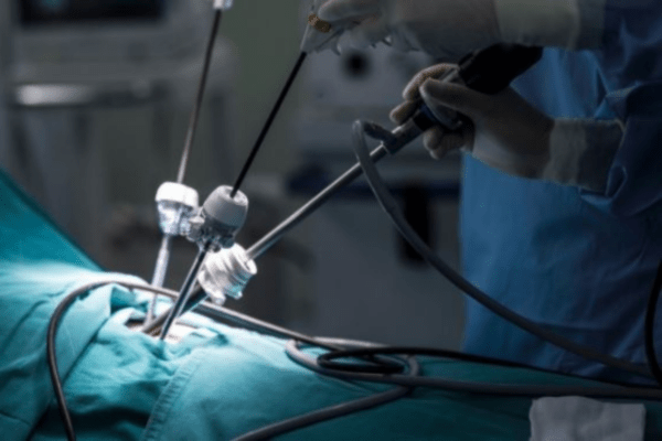 Laparoscopic Surgeon in Chennai