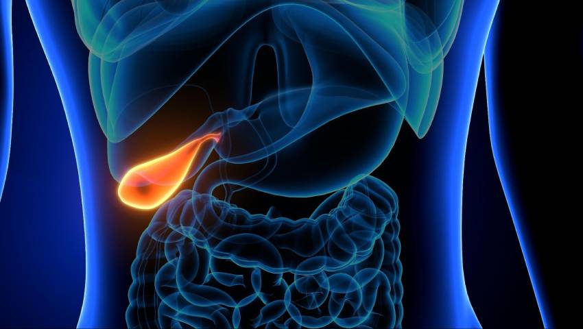 Five tips for the prevention of Gallstone_ Dr. Srivatsan Gurumurthy