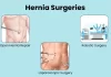Different types of hernia surgery – open, laparoscopic, and robotic repair explained by Dr. S. Srivatsan Gurumurthy, hernia surgeon in Chennai.