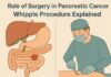 Whipple procedure explained for pancreatic cancer treatment by Dr. Srivatsan Gurumurthy in Chennai